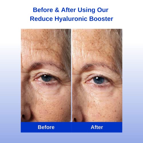 Reduce Hyaluronic Booster Plus